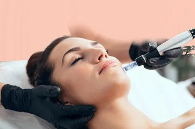 Microneedling Special